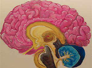 Perioperative_Brain_Picture