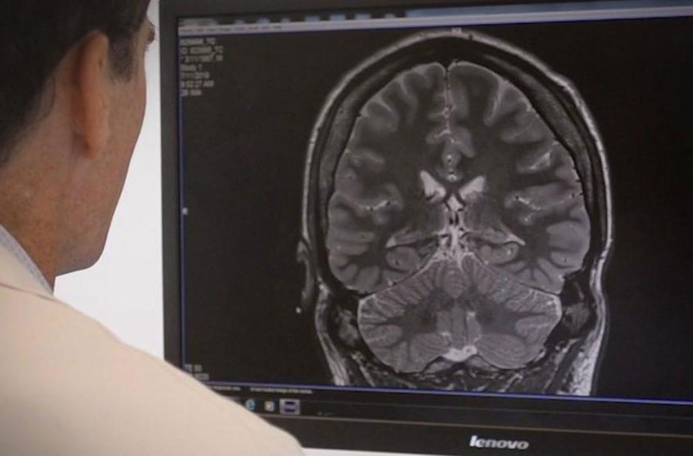 Doctor reviewing MRI