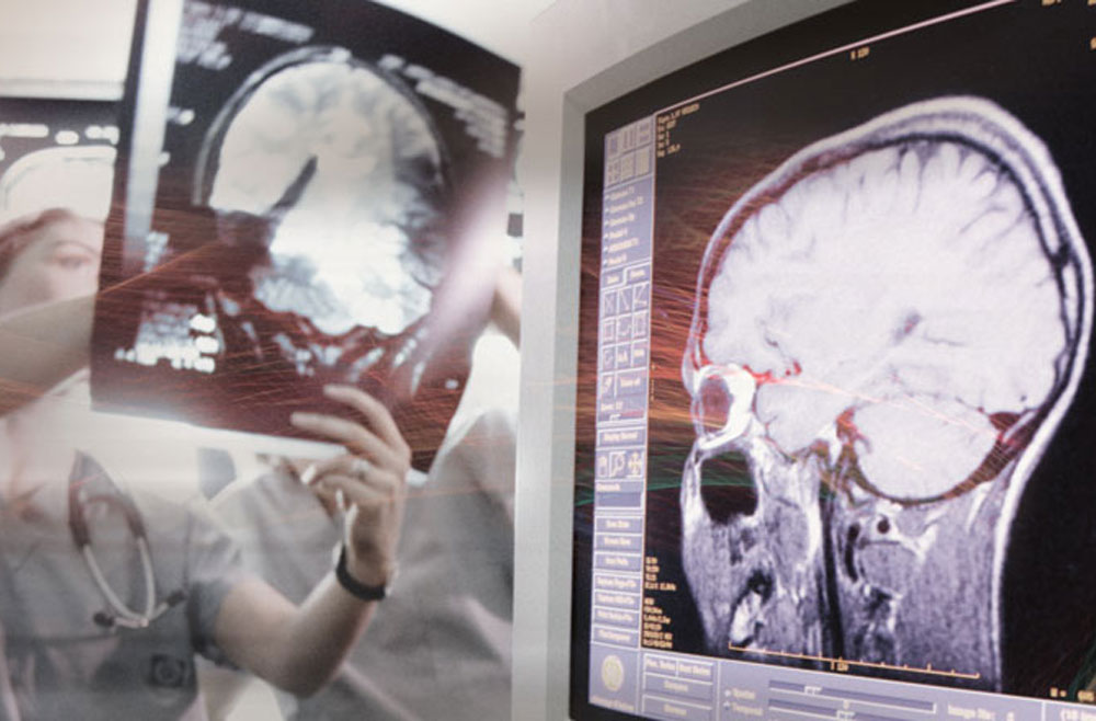 Doctor reviewing brain scan