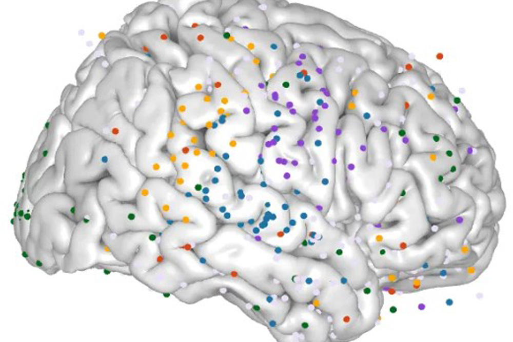 Brain Mapping