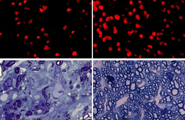 RGCs treated and untreated 