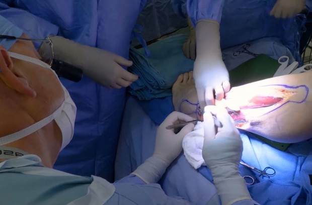 Dr. Levin operating on leg