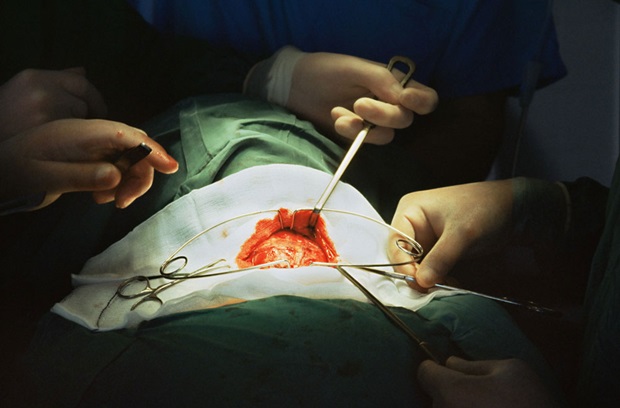 Grafting surgery