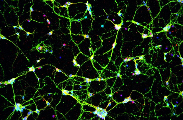 Neurons and synapses