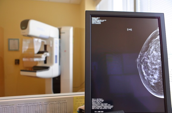 bucks_breast_mri_2
