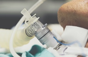 Tracheotomy image demonstrating tube attachment at neck.