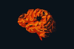 traumatic brain injury