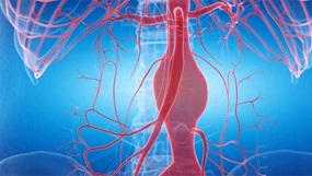animated aorta