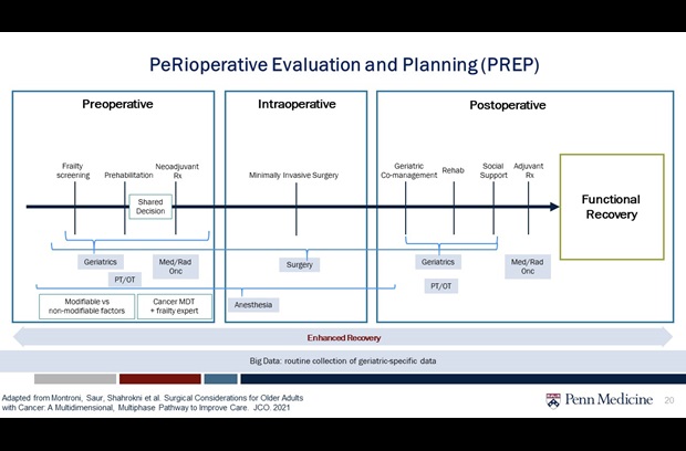 illustration of the prep phases