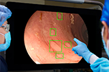 gi genius monitor in use