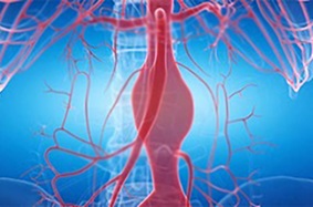 Animated aorta