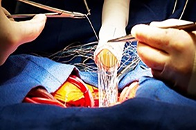 Cardiac surgery