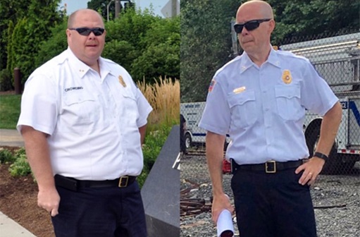 Before and after bariatric surgery Beau Crowding