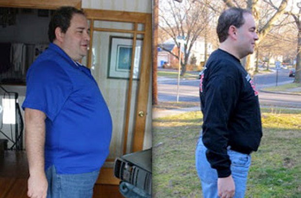 Bruce, before and after shots