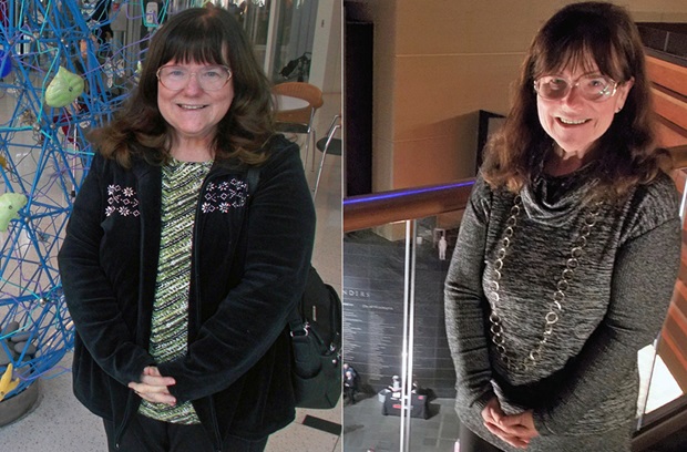 Side-by-side shots of Cheryl before and 30 months after bariatric surgery