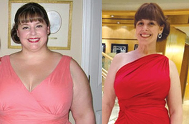 Chiara, before and after shots