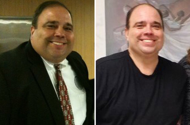 Lou Before and After
