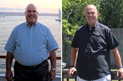 Ray Before and After