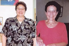 Susan Before and After