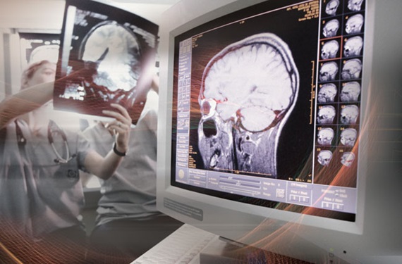 Neuroscience imaging
