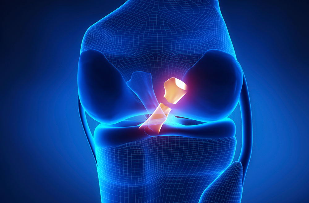 Anterior cruciate ligament