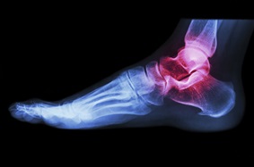 Injured ankle