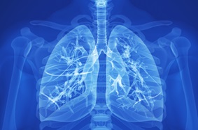 lung x-ray