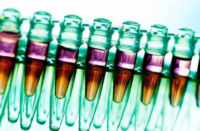 lab rack samples
