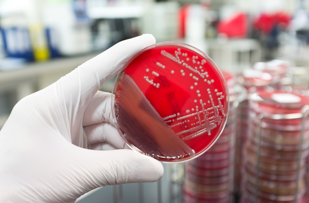 white_gloved_hand_looking_at_bacteria_in_petri_dish