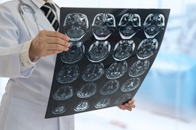 Doctor hold EEG image of brain patient at operating room in hospital.