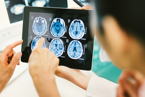 brain_scans_tbi