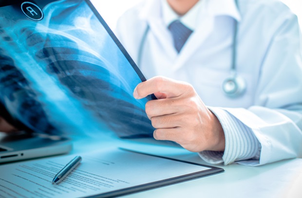 doctor looking at spinal cord xray