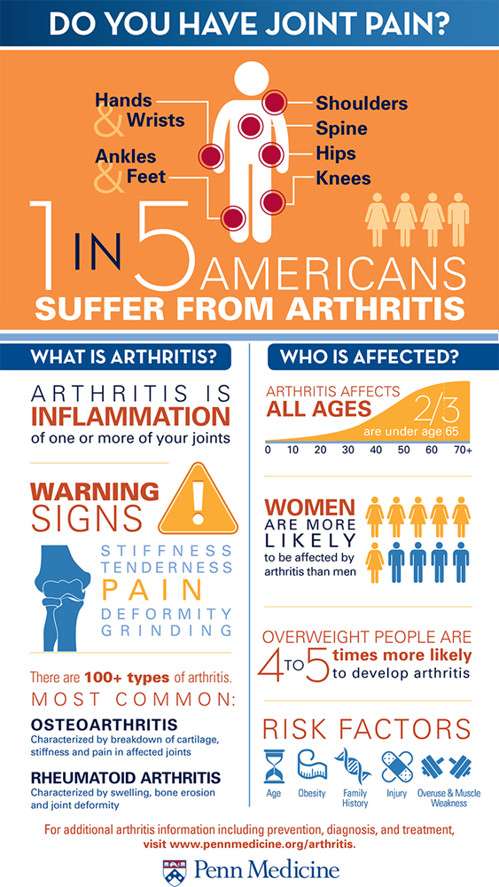 Arthritis risk infographic