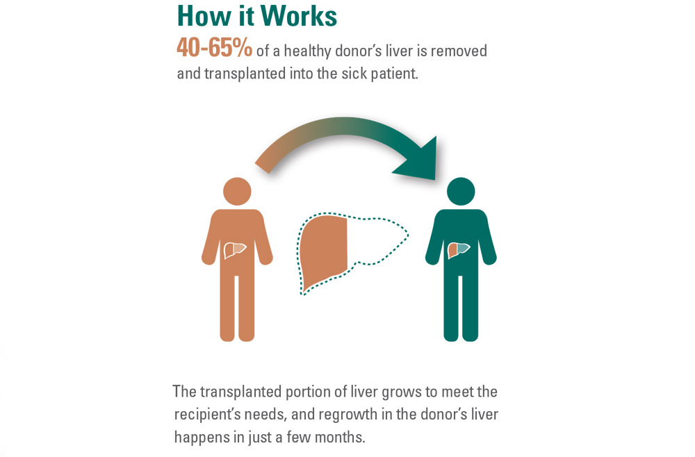 How it works infographic: 40 to 64% of the healthy liver is transplanted