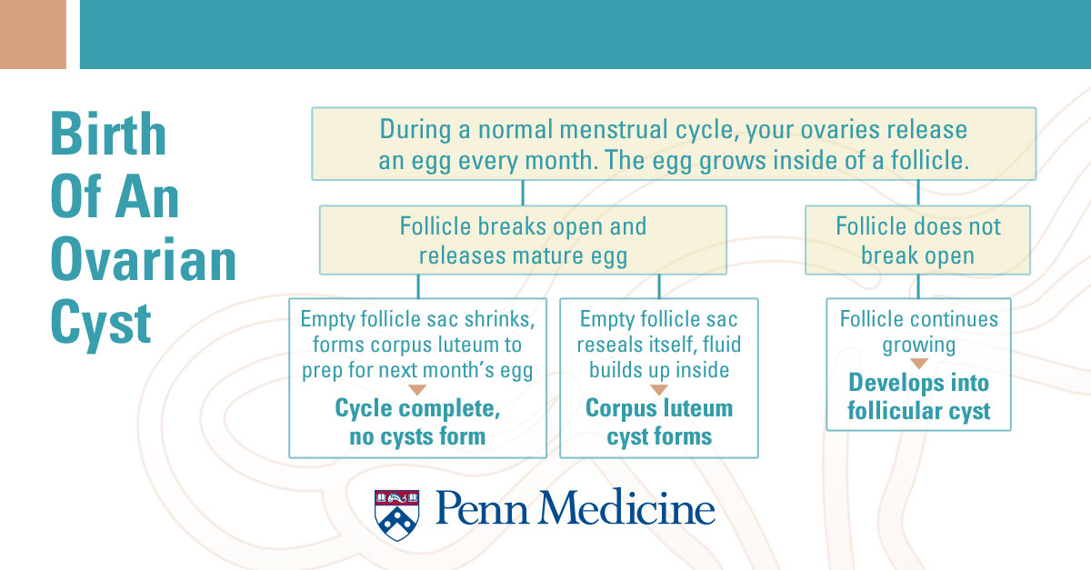Birth of an ovarian cyst