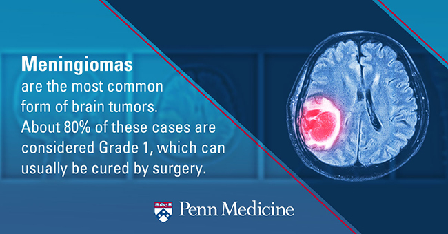 brain tumor mengioma