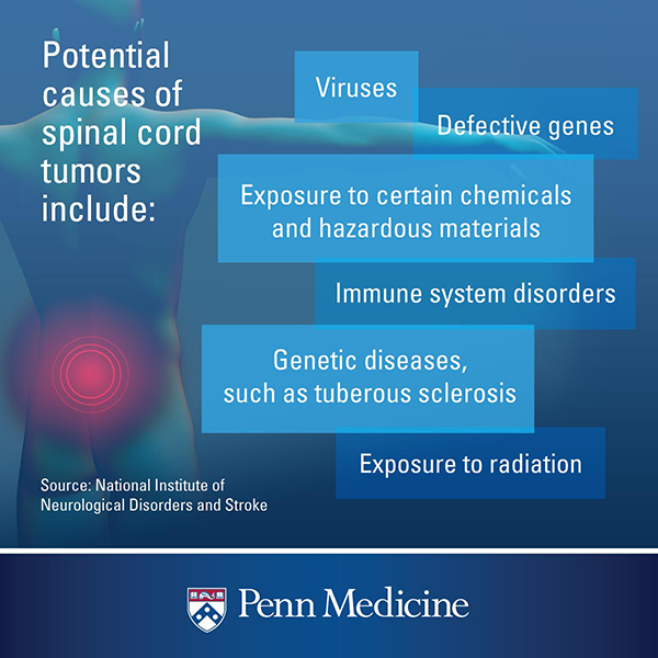 spinal tumor