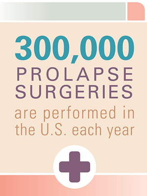 Prolapse surgery graphic