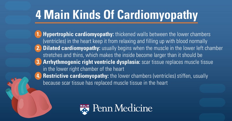 Types of cardiomyopathy