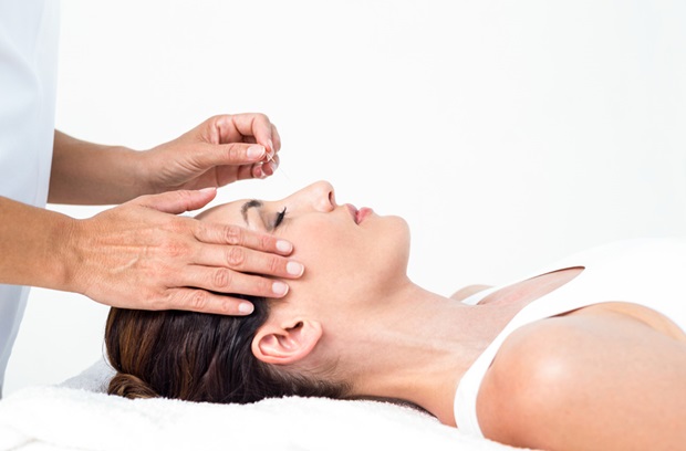 woman getting acupuncture