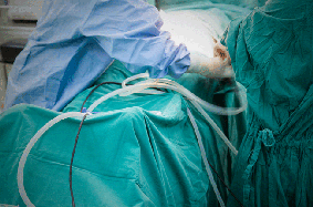 gastric surgery