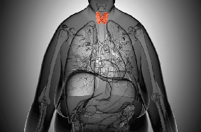 overweight person with thyroid cancer
