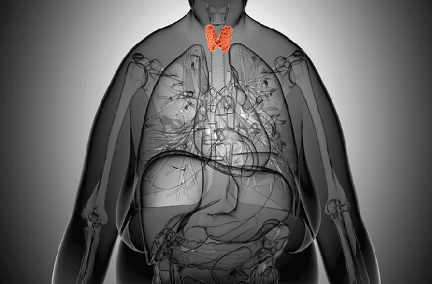 overweight person with thyroid cancer