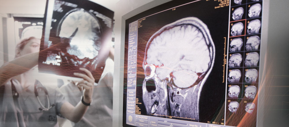 Penn Medicine Neuroscience Center