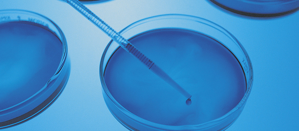 Petri dishes and pipette 